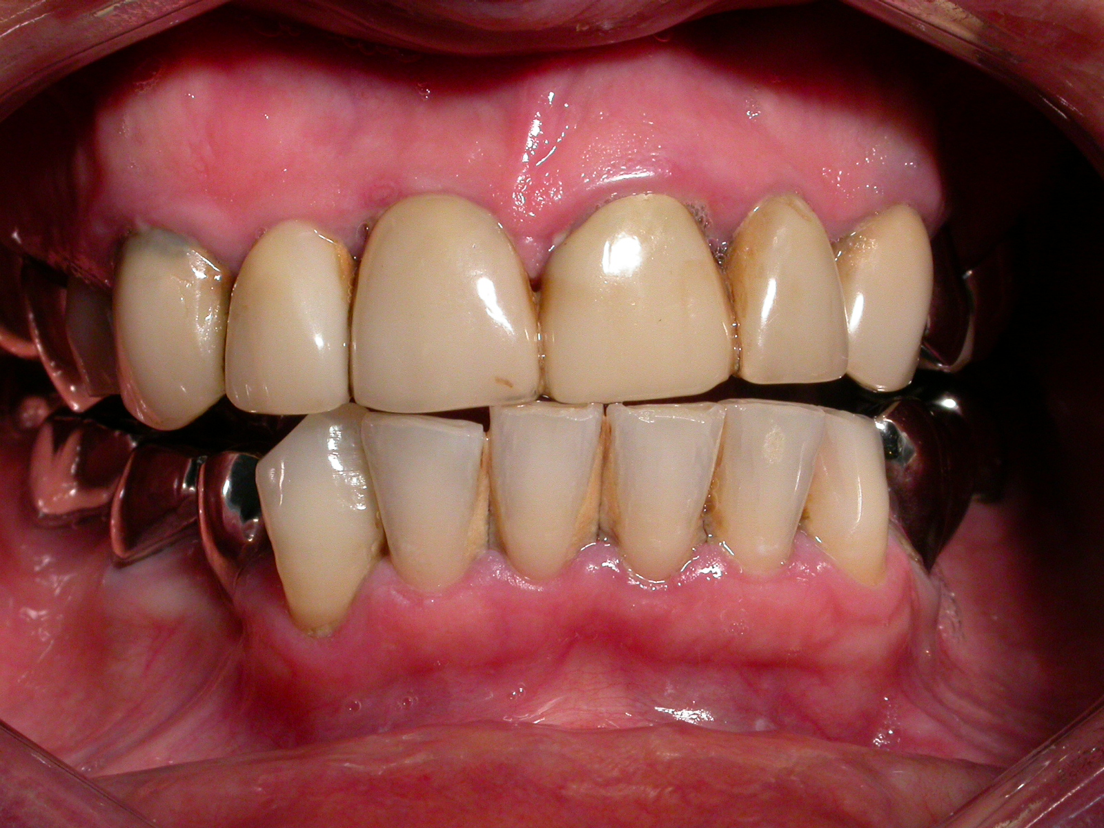 dentiste bron